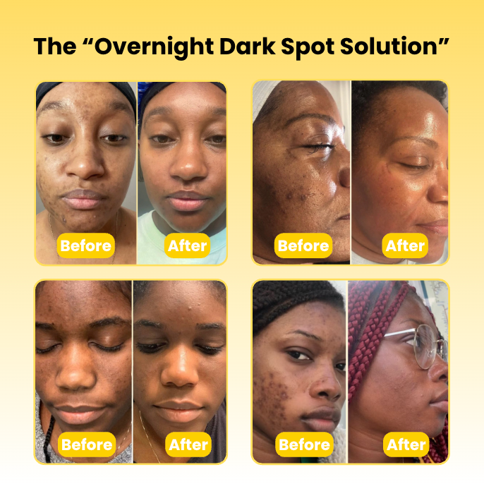 KOJICUR Overnight Glow Mask